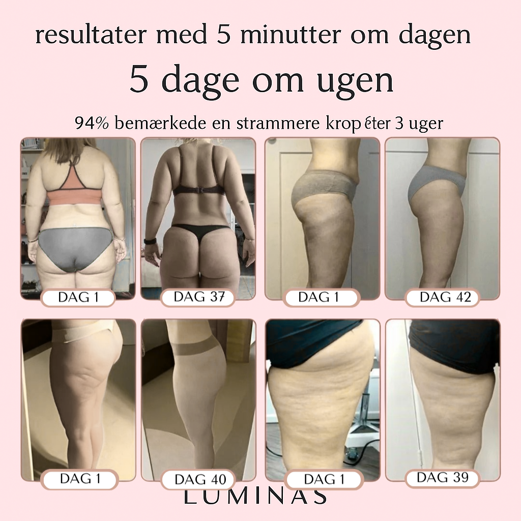 Luminas - Cellulitisfjerner